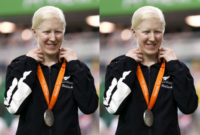 Paralympian Emma Foy Takes Time Out